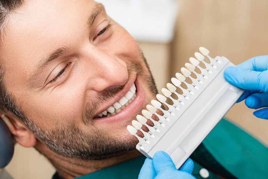 Are Dental Veneers Worth It?