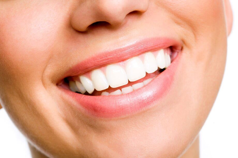 How Long Does Professional Teeth Whitening Last?