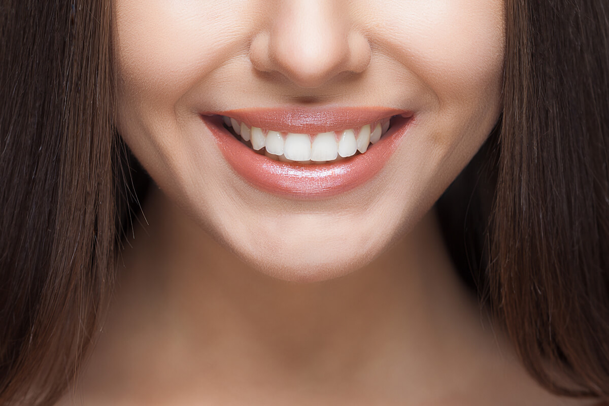 how-long-does-teeth-whitening-last-emerson-dental